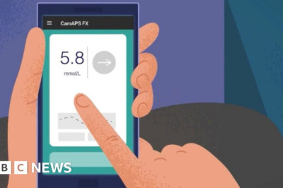 Google rules blocked children's diabetes app