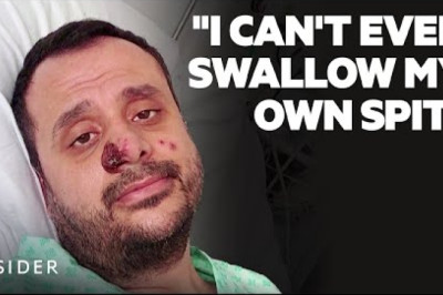 Everything We Know About Monkeypox | Insider News