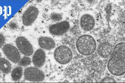 How monkeypox spreads