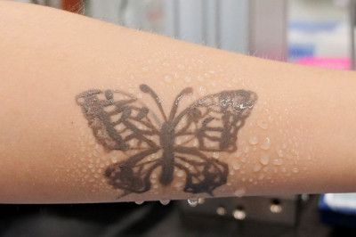 South Korea develops nanotech tattoo as health monitoring device